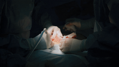 Journal of Case Reports in Surgery